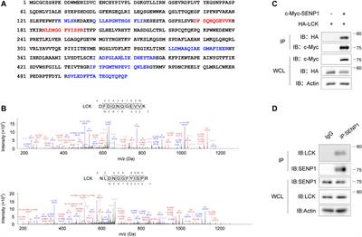 TCR-Induced Tyrosine Phosphorylation at Tyr270 of SUMO Protease SENP1 by Lck Modulates SENP1 Enzyme Activity and Specificity